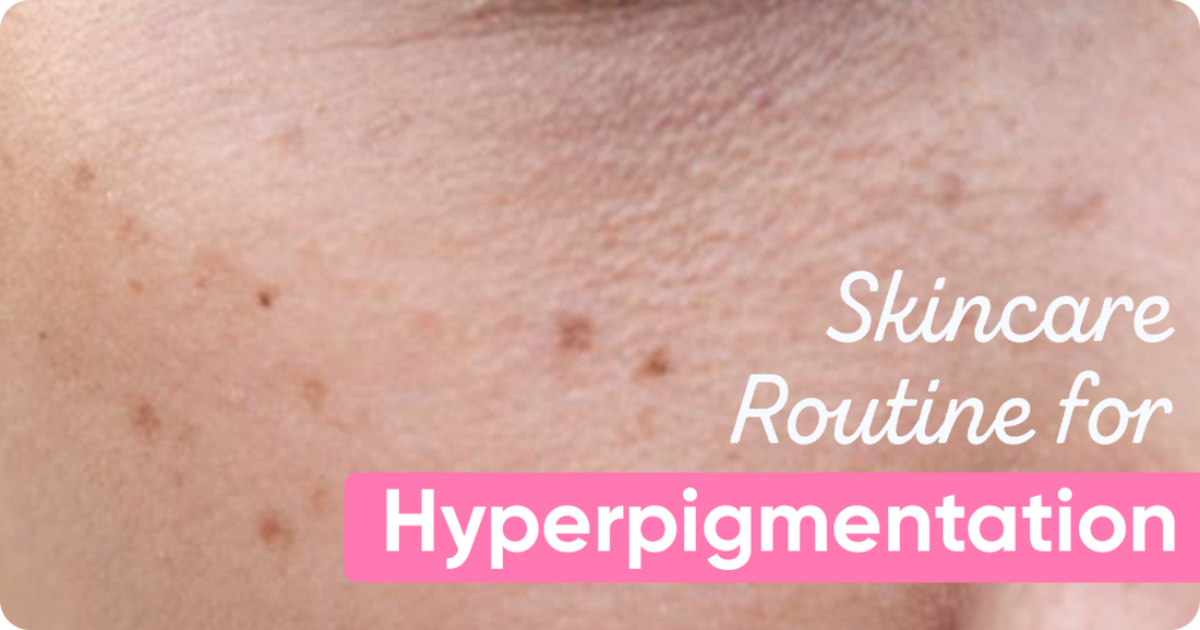 Skin Care Routine for Hyperpigmentation