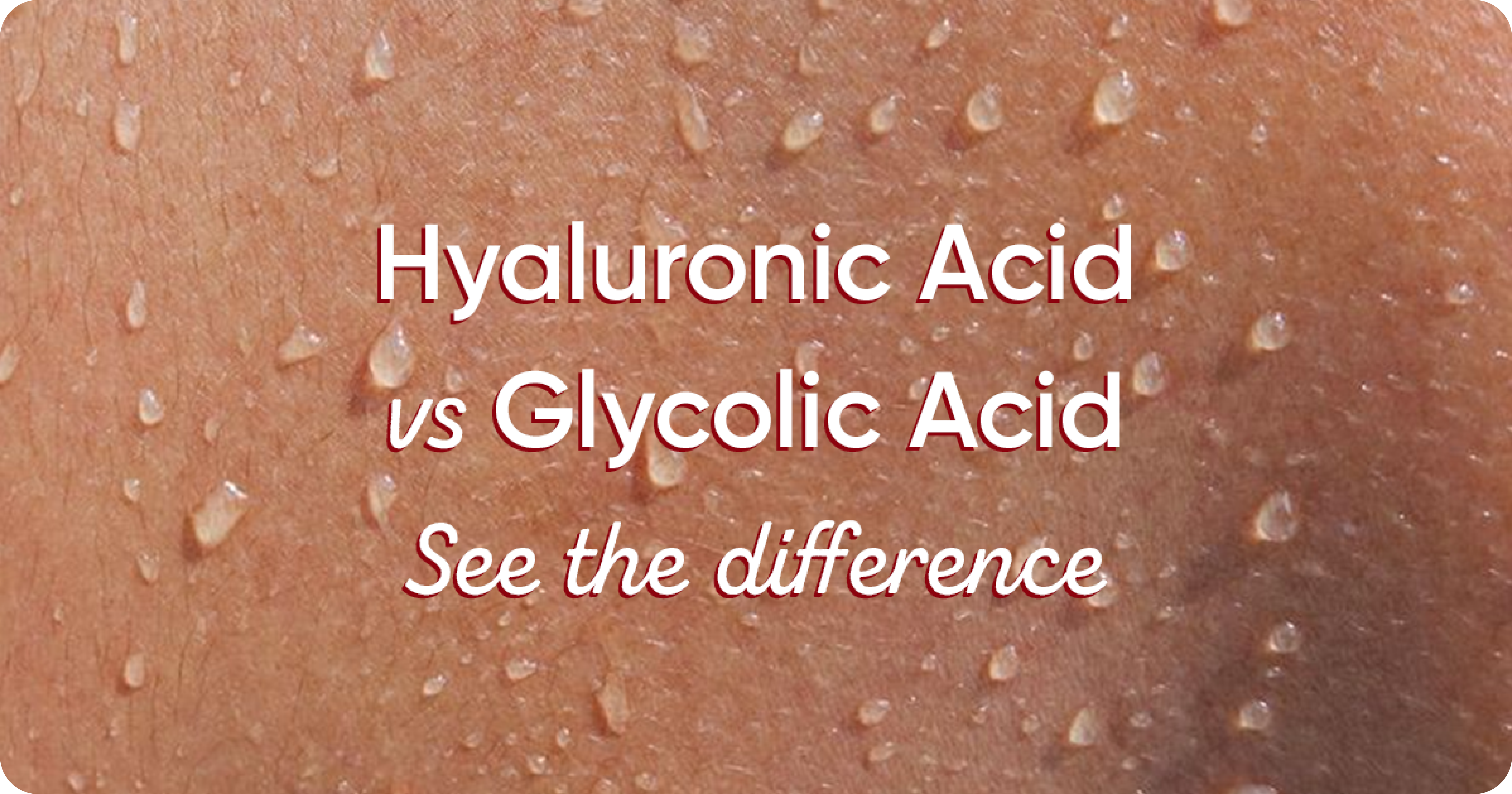 Hyaluronic Acid vs. Glycolic Acid: Which is Better for Skin?