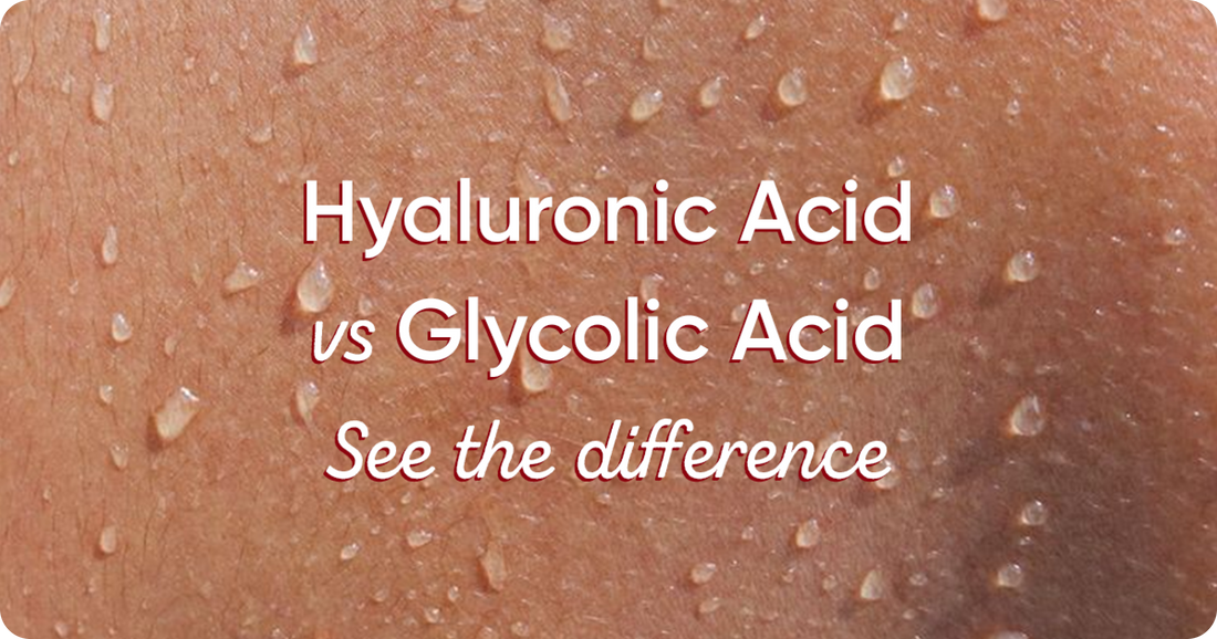 Hyaluronic Acid vs. Glycolic Acid: Which is Better for Skin?