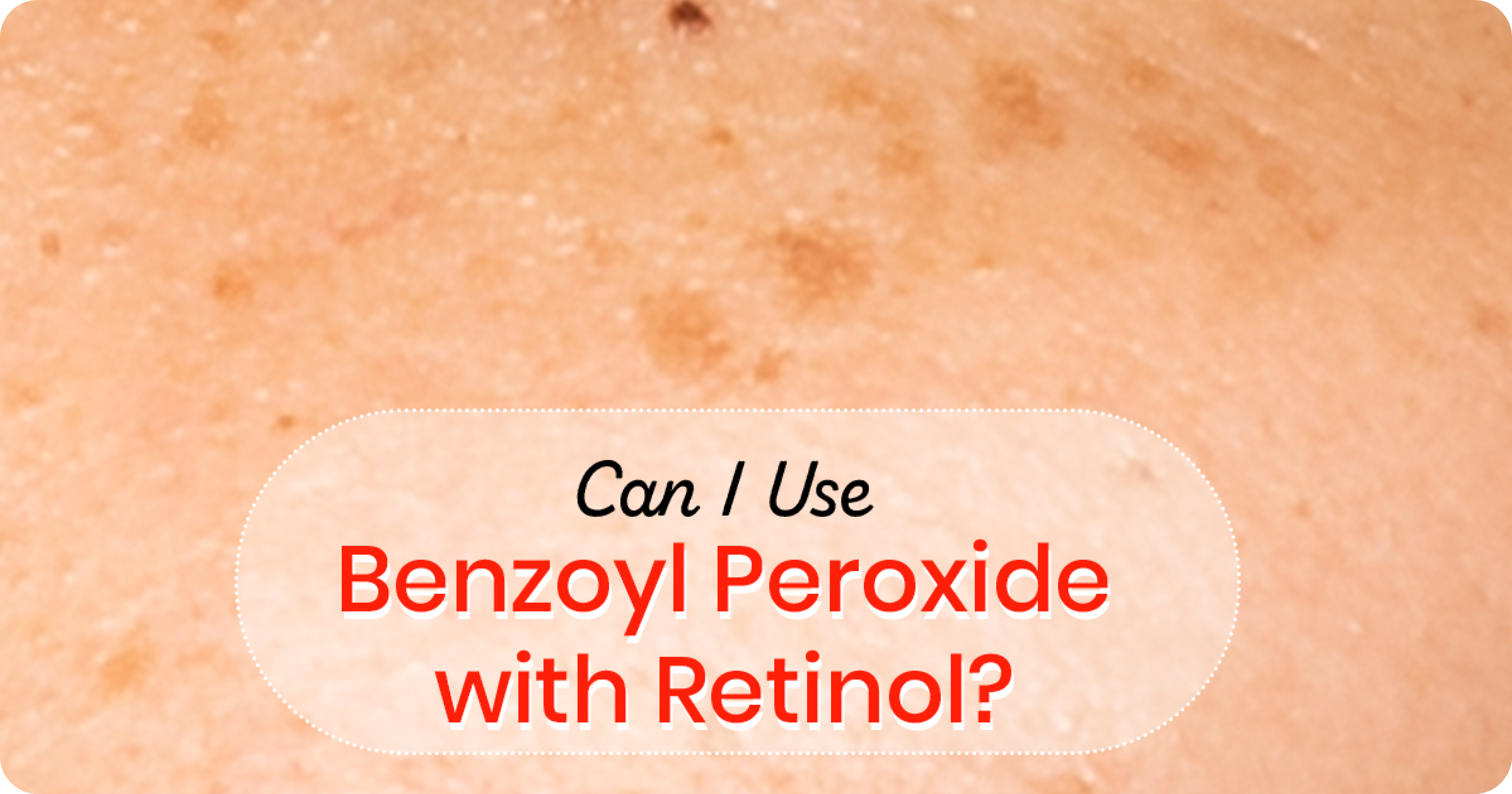 Can You Use Benzoyl Peroxide with Retinol?