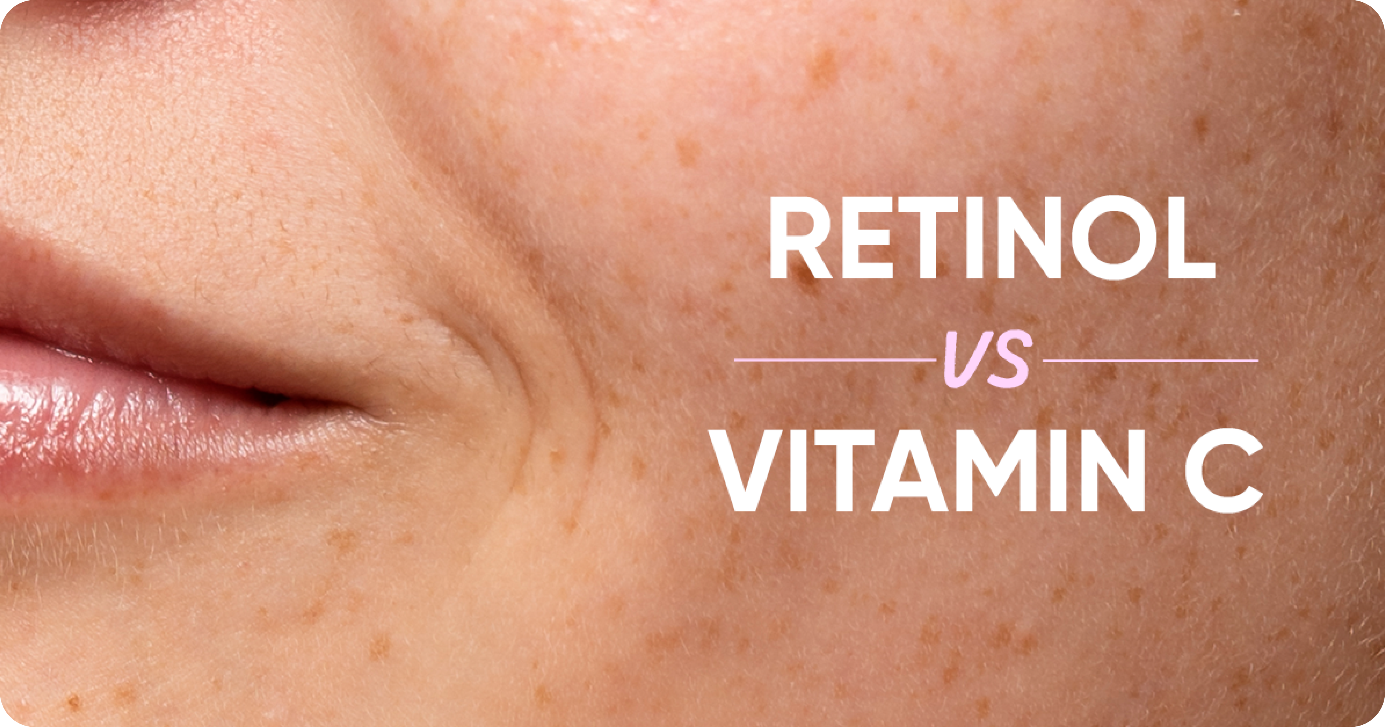 Retinol vs. Vitamin C: Which One is Better for Your Skin?